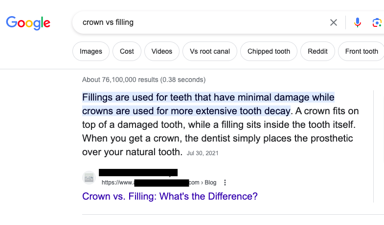 Google Search Results page showing the featured snippet for "Crown vs Filling" search